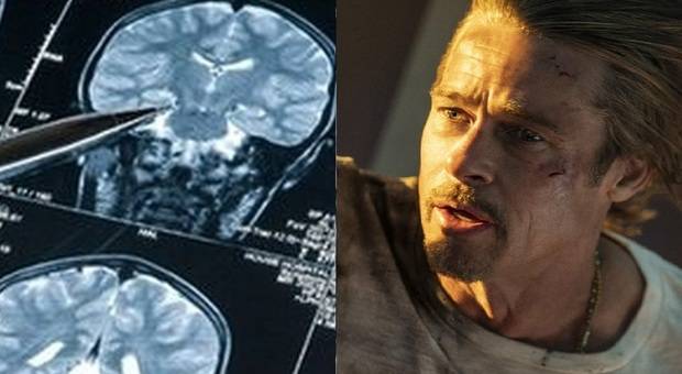 Brad Pitt'in Hastalığı Prosopahnasia Türkiye'de De Çıktı 11